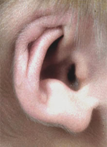 Cryptotia