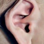 newborn ear deformities