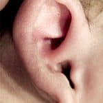 newborn ear deformities