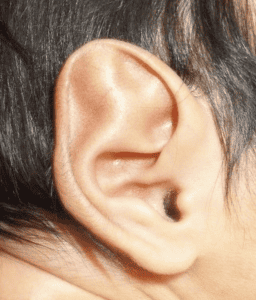 Pointy Ears in Newborns