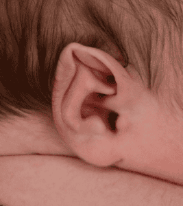 Pointy Ears in Newborns